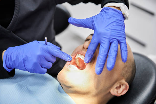 Best Emergency Wisdom Teeth Removal in Royston, GA